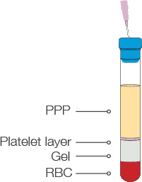 Gel separates platelets from PPP, RBC and granulocytes. Platelets reside on top of the gel. Insert the vented needle into the tube