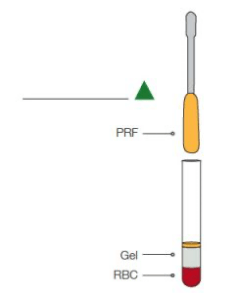 Tropocells® PRF is ready to use